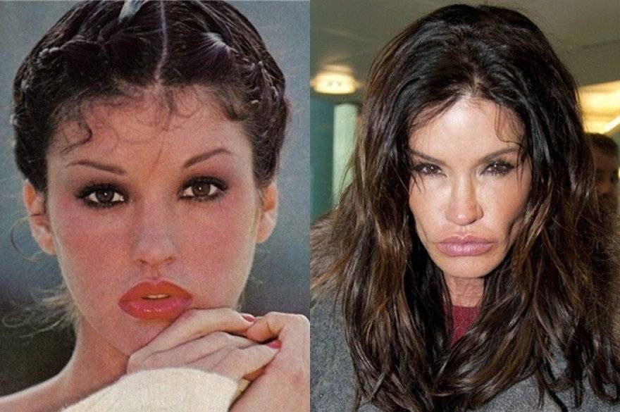 Анджелина джоли до и после пластических операций – фото и версии экспертов