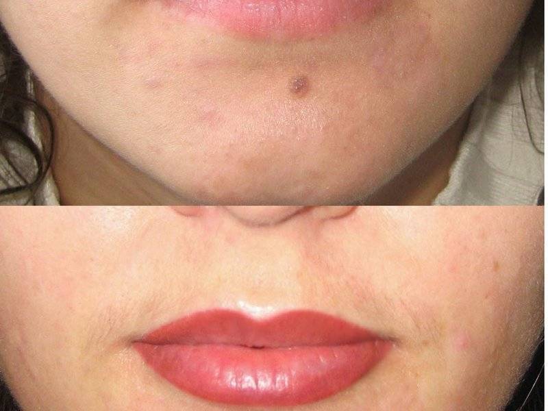 Перманентный макияж губ (татуаж губ) - что это, фото до и после