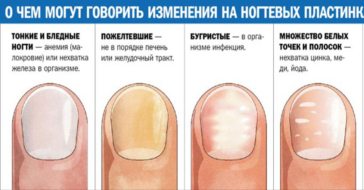 Белые следы на ногтях