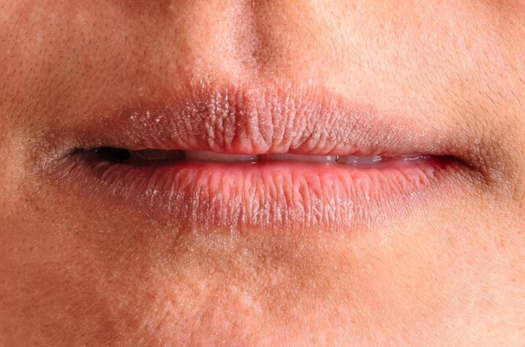 Трещины на половых губах