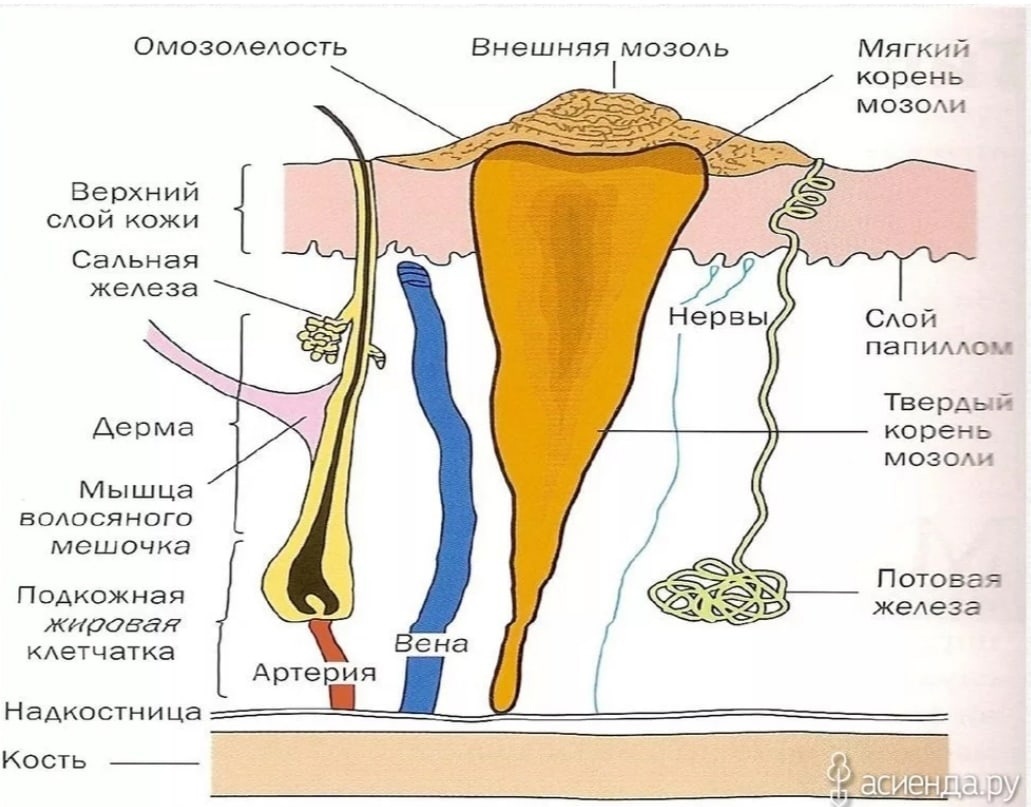 Стержневая мозоль корневая система