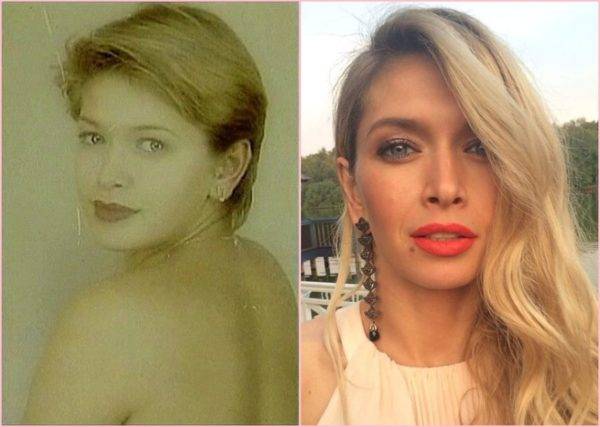 Вера алентова: какие пластические операции делала  – фото до и после: что случилось с ее лицом? +фото и видео
