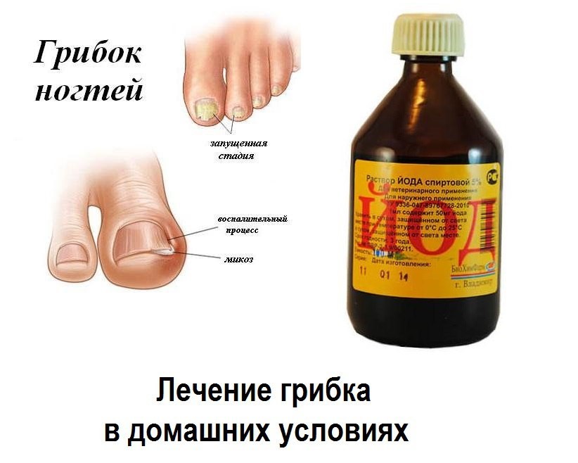 Болит и опух палец на ноге | сеть клиник «здравствуй!»