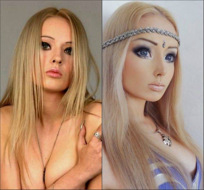 Валерия лукьянова до и после пластики, фото «живой барби» - 300 экспертов.ру