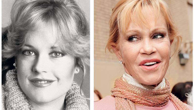 Фотографии актрисы рене зеллвегер — до и после пластики