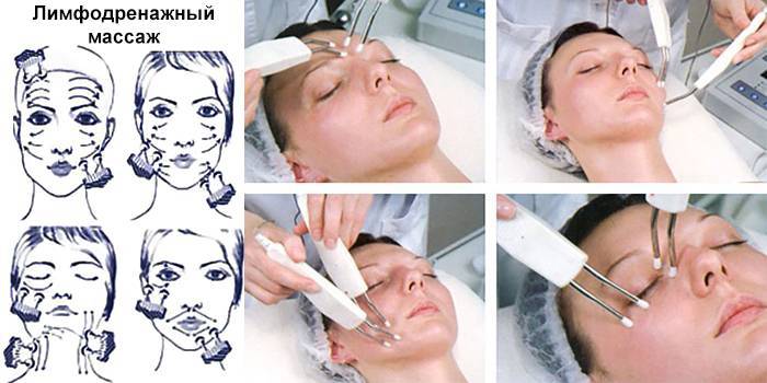 Как правильно делать лимфодренажный массаж для области глаз?