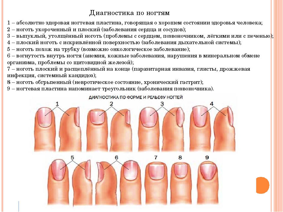 Вальгусная деформация пальца стопы: причины, симптомы и лечение