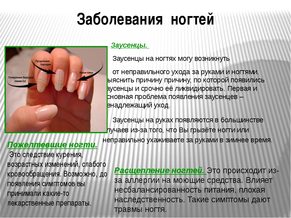 Заболевания и травмы ногтей – какие они бывают и почему появляются.