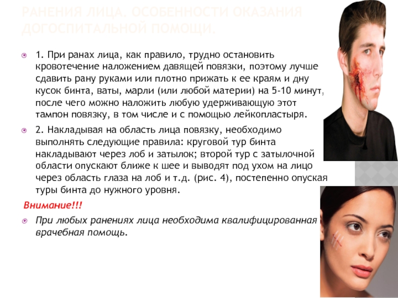 Птоз (опущение), примеры работ до и после