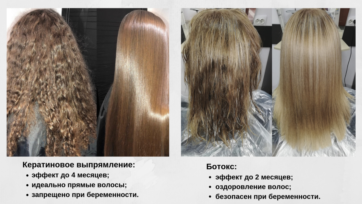 Ботокс: плюсы и минусы процедуры