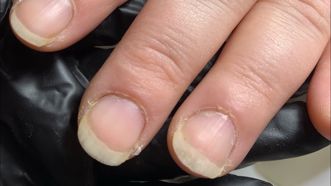 Толстые ногти – все о красоте и не только