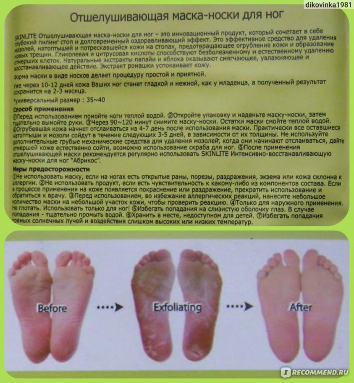 Как выбрать пилинг для сухой и жирной кожи, в чем особенности различных видов пилинга | портал 1nep.ru