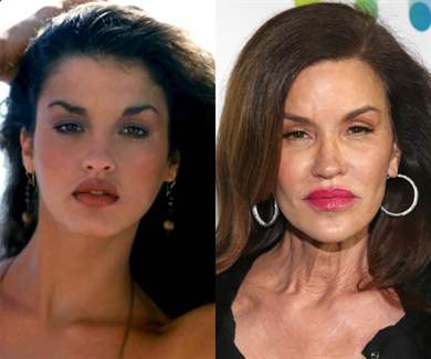 Фотографии актрисы рене зеллвегер — до и после пластики