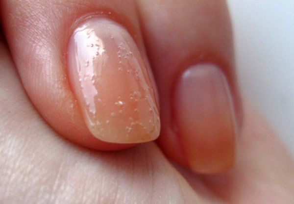 Почему образуются пузырьки на ногтях после нанесения и высыхания лака?