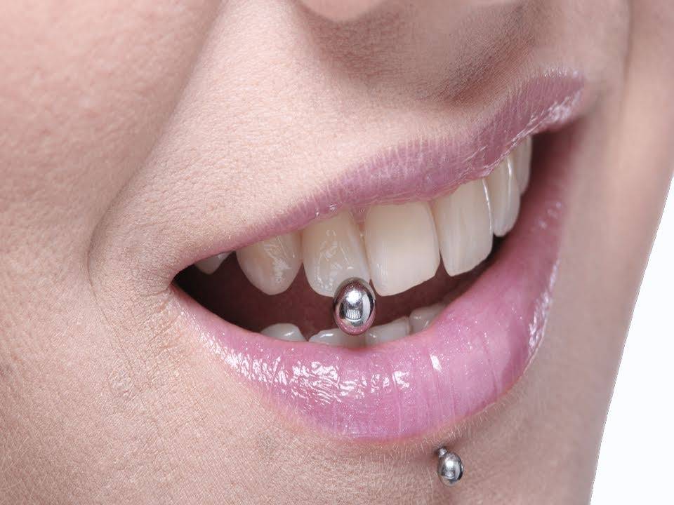 Социальная стоматология | вашим зубам не хватает блеска – на помощь придет скайс. как украсить зубы скайсами?