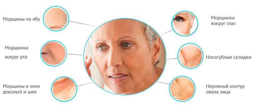 Внешние признаки старения - 6 главных маркеров старения лица и шеи и методы их коррекции