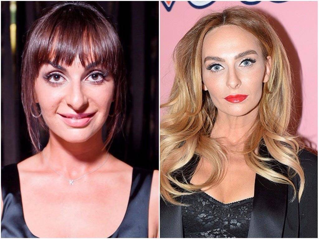 Екатерина варнава до и после пластики носа, груди и лица. какие операции делала актриса и как она похудела – фото 2020 года