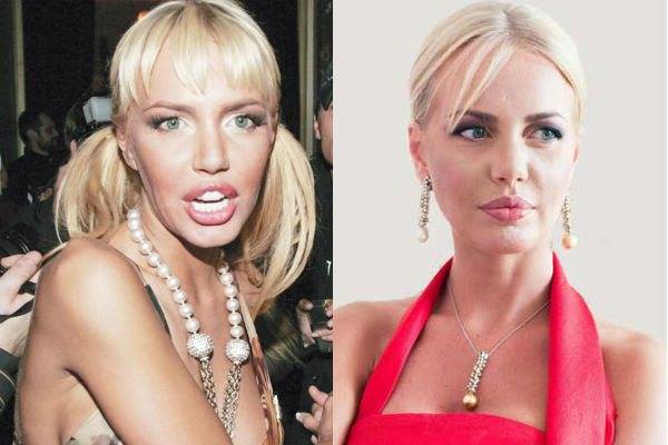 Малиновская маша до и после пластики, неудачная операция, внешность в 2021, почему она стала жертвой