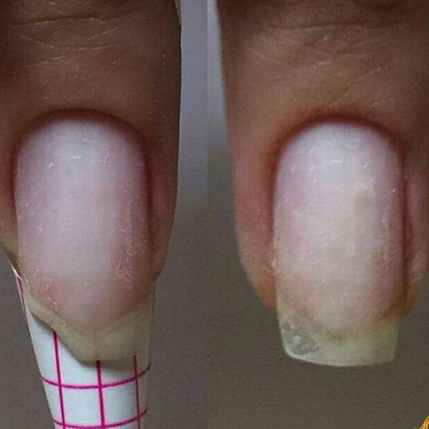 Почему нарощенные ногти быстро отваливаются и как очень быстро отрастить ногти?