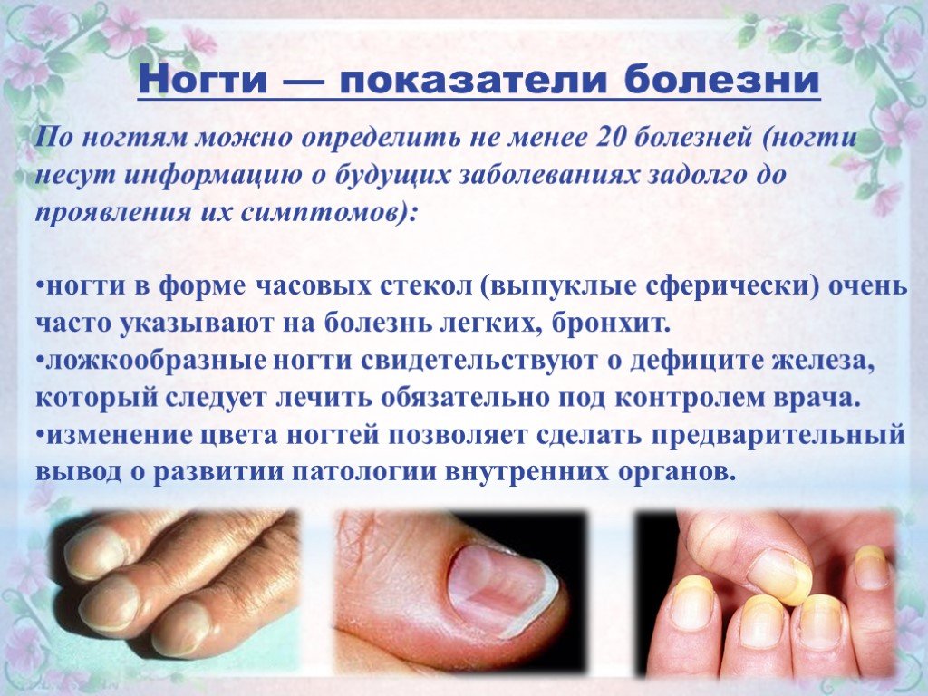 Связь болезней и внешнего состояния ногтей