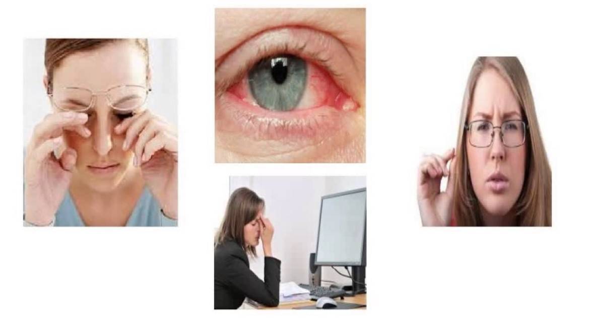 Упражнения для глаз: рекомендации (сергиев посад) | парацельс