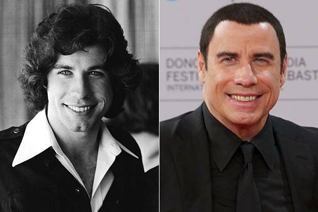 Знаменитые мужчины, которые перестарались с пластическими операциями: фото до и после
