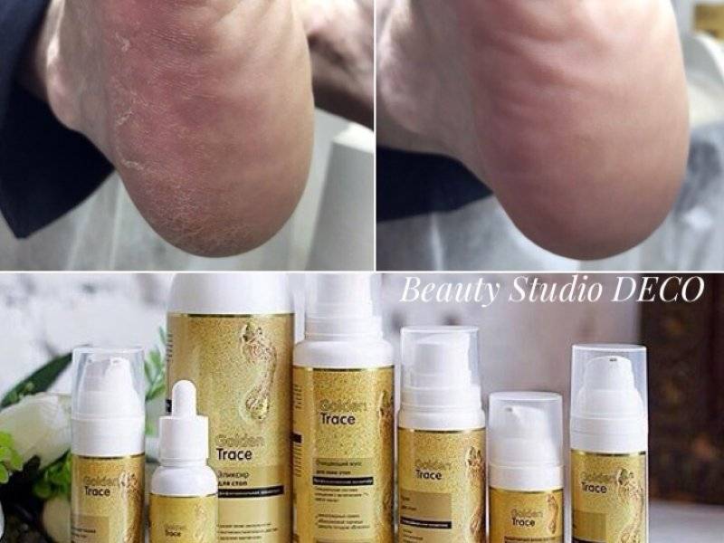 Кислотный педикюр, пробуем пилинг с кислотами