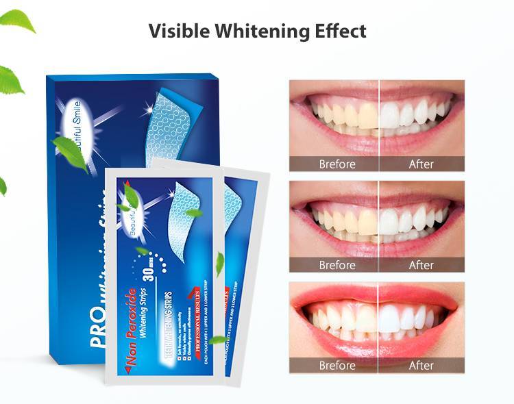 Отбеливающие полоски для зубов: применяем с пользой