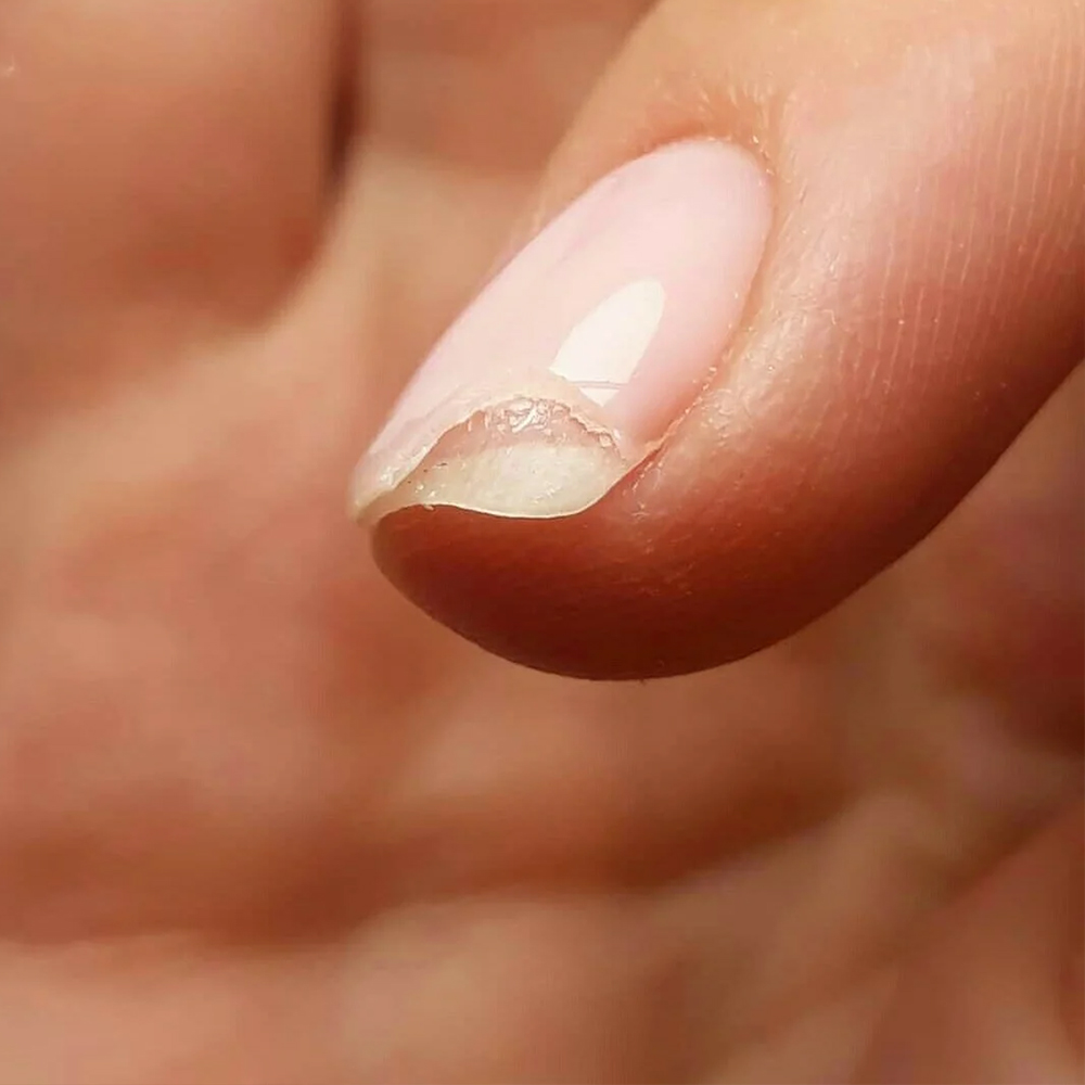 Почему гель-лак быстро отслаивается от ногтя - основные причины