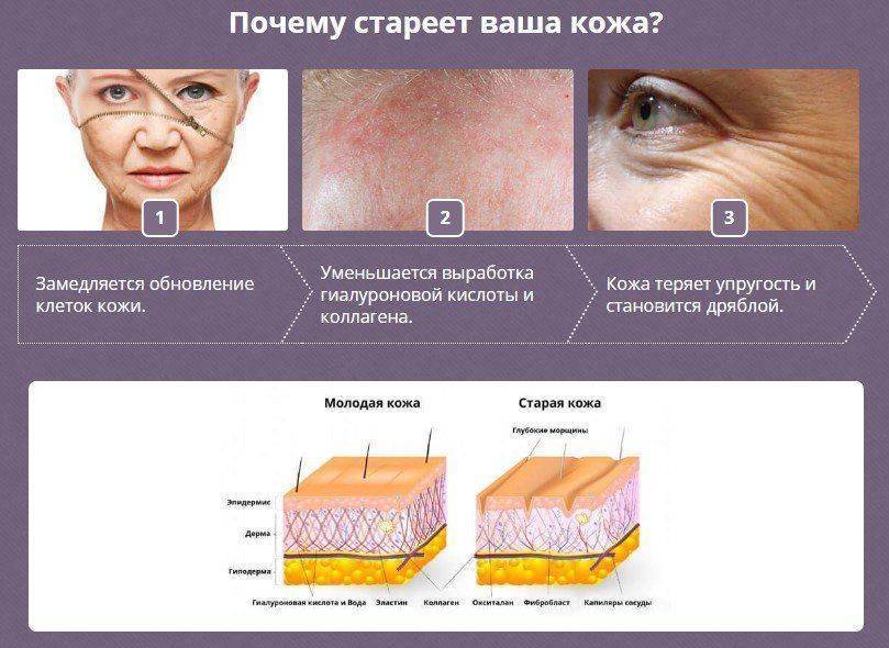 Типы старения кожи. определяем тип кожи и морфотип старения