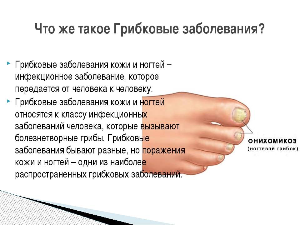Псориаз ногтей - лечение