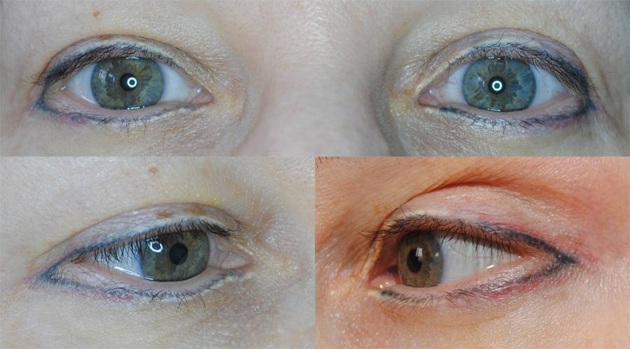 Как выглядит и сколько держится татуаж стрелки на глазах: особенности процедуры, фотографии