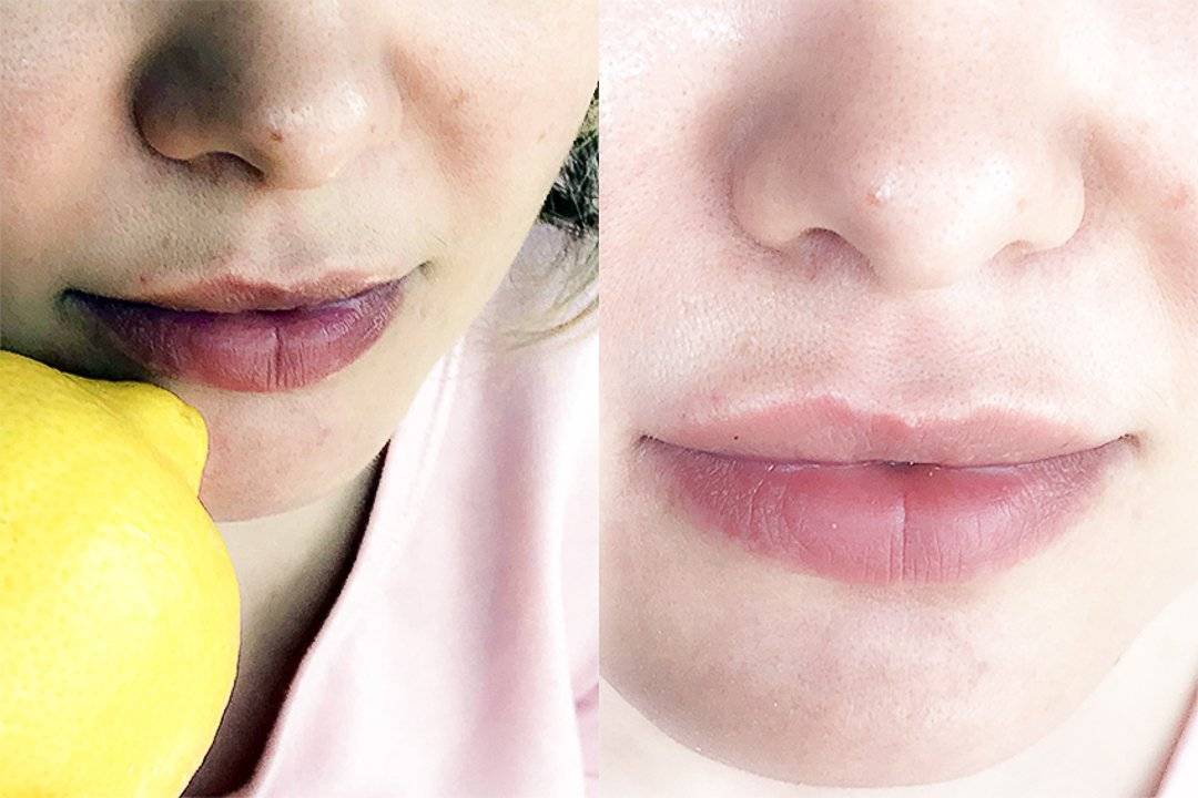 Как сделать губы пухлыми в домашних условиях - 12 народных средств увеличения губ