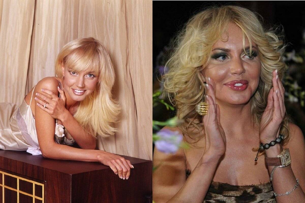 Маша Малиновская до и после пластических операций. Фото, возраст, рост и вес