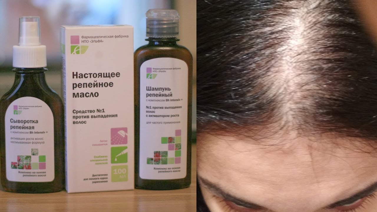 Восстановление после родов – как восстановиться после родов и как быстро восстанавливается организм - agulife.ru