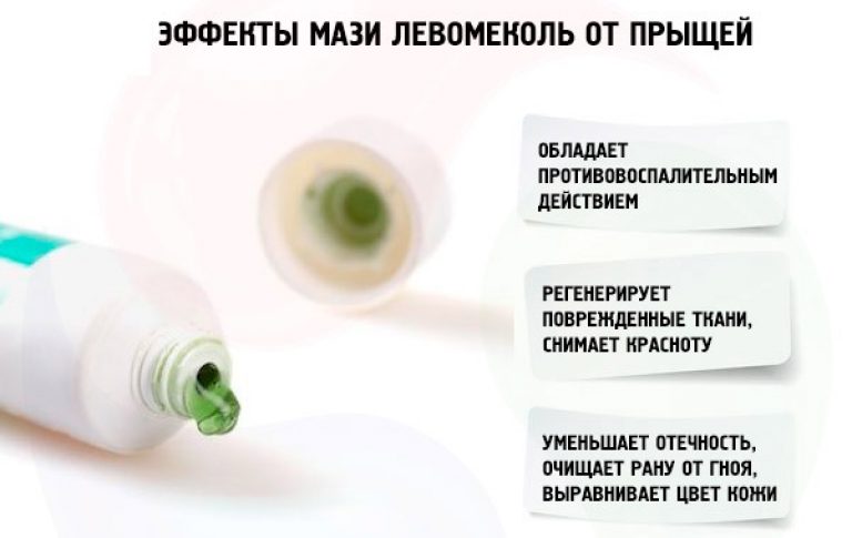 Лечение угревой сыпи оральными антибиотиками: в каких случаях оно оправдано?