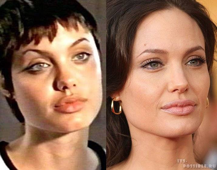 Губы после 40 лет. Анджелина Джоли скулы в молодости. Губы Анджелины Джоли до и после. Анджелина Джоли скулы пластика. Анджелина Джоли пластика лица.