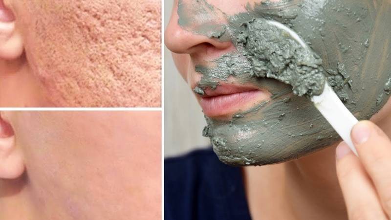Какая чистка лица лучше для вашей кожи