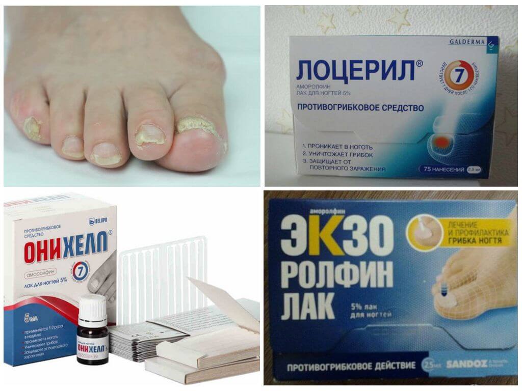 Топ-15 препаратов от грибка на ногтях