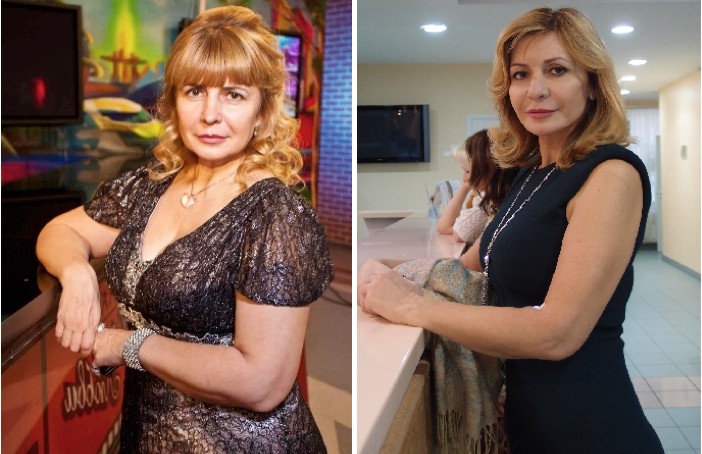 Ирина агибалова – неудачная пластическая операция, фото до и после