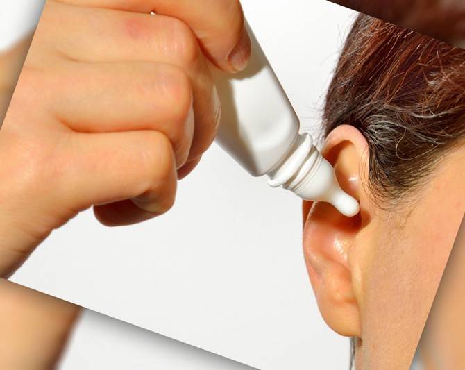 Как убрать серную пробку из уха: лечение и профилактика