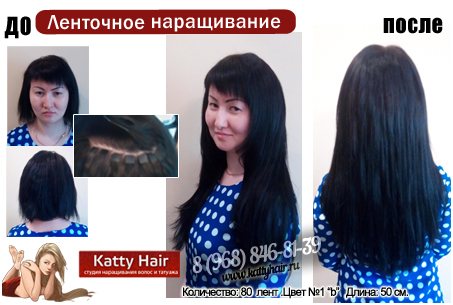 Нитевой лифтинг: плюсы и минусы процедуры | expert clinics