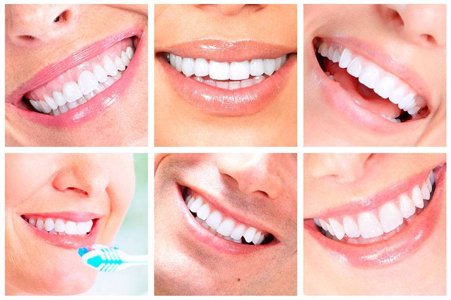 Вредно ли отбеливание зубов или нет? мифы про отбеливание zoom и кабинетное отбеливание лампой