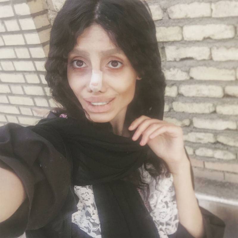 Сахар табар- пластические операции иранской девушки-зомби » womanmirror
сахар табар- пластические операции иранской девушки-зомби