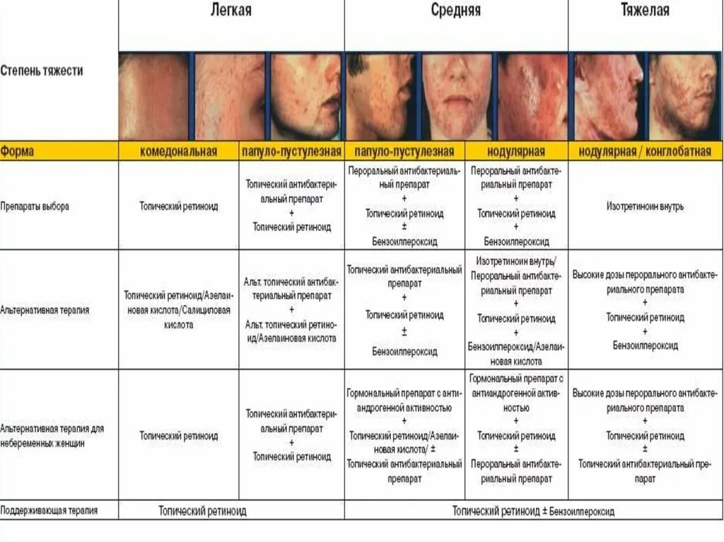 Схема лечения акне