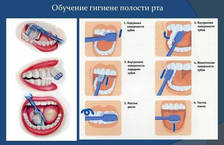 Профилактика заболеваний полости рта