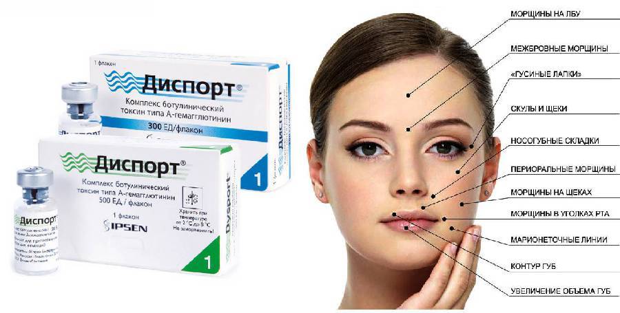 Диспорт (dysport) – препарат для устранения мимических морщин