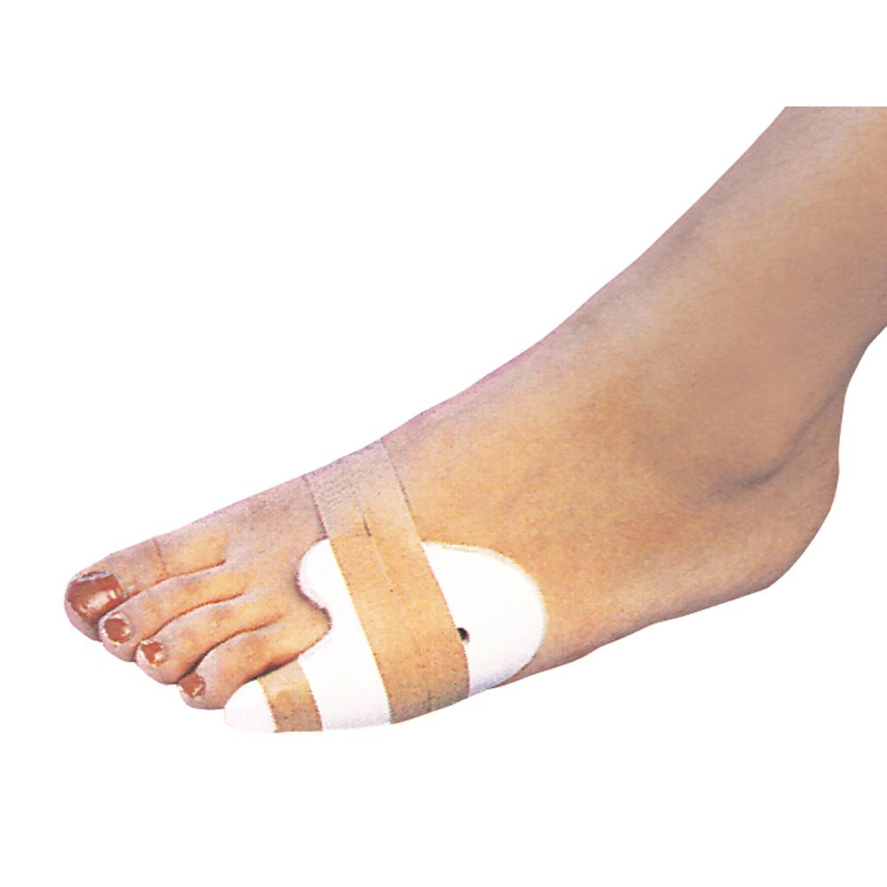 Как лечить ушиб пальцев ног: 14 шагов