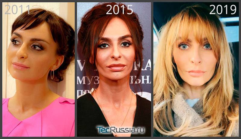Екатерина варнава: фото до и после операции, какой была