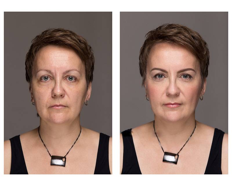 Омоложение лица после 50 лет без операции - советы от косметологов| статьи